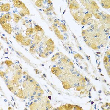 Immunohistochemistry - C4BPB antibody (144-06362)