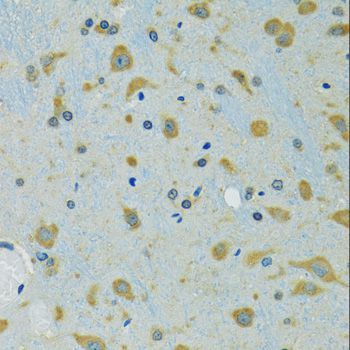 Immunohistochemistry - RPS7 Polyclonal Antibody (144-06731)