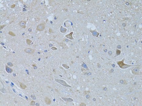 Immunohistochemistry - FDFT1 antibody (144-06229)