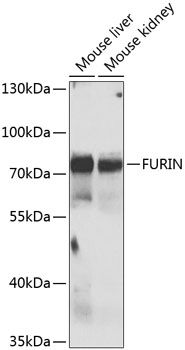 Western blot