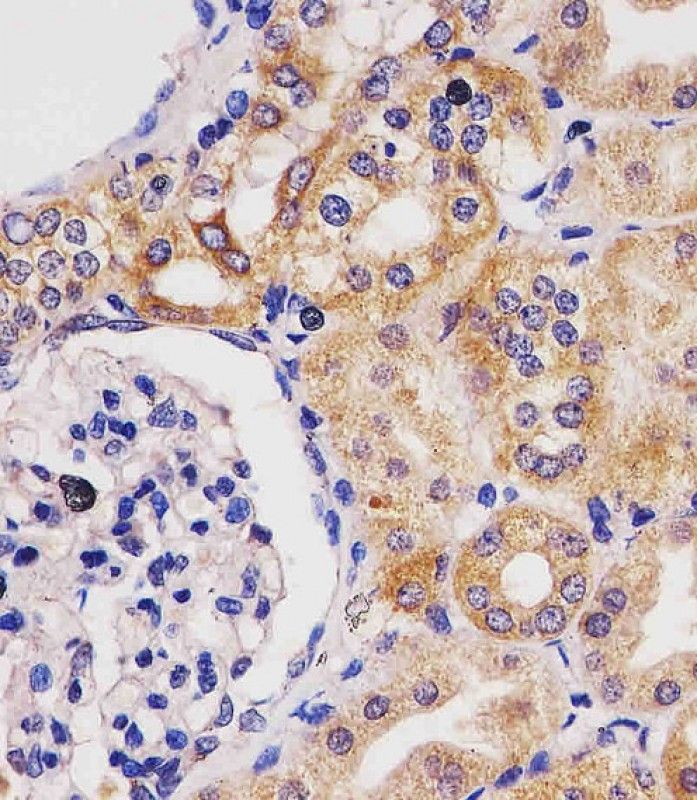 IHC-P