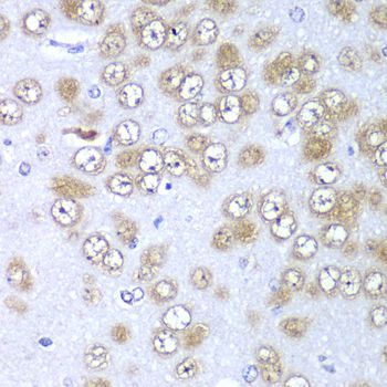 Immunohistochemistry - RPS10 antibody (144-06056)