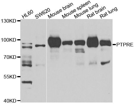 Western blot - PTPRE antibody (144-07209)