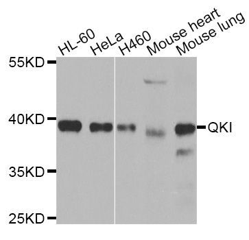 Western blot - QKI Polyclonal Antibody (144-07043)