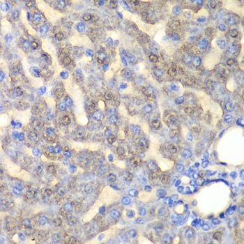 Immunohistochemistry - FAH antibody (144-60359)