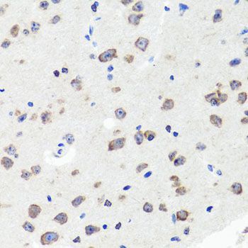 Immunohistochemistry - DLG1 antibody (144-08542)
