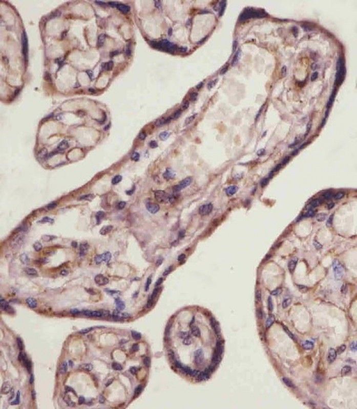 IHC-P