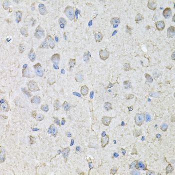 Immunohistochemistry - CD97 antibody (144-03780)