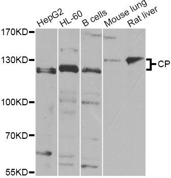 Western blot - CP Antibody (144-07658)
