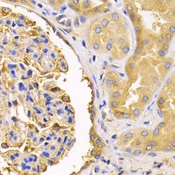 Immunohistochemistry - USO1 Polyclonal Antibody (144-02796)