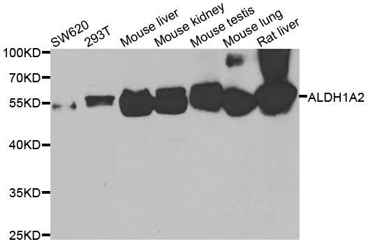 Western blot - ALDH1A2 antibody (144-07503)