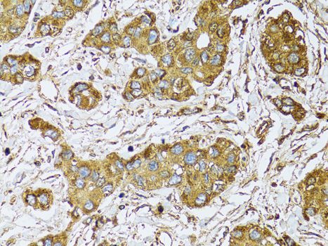 Immunohistochemistry - UGDH antibody (144-01210)