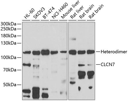 Western blot