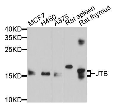 Western blot - JTB Polyclonal Antibody (144-10427)