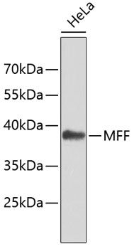 Western blot