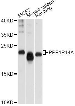 Western blot - PPP1R14A Polyclonal Antibody (144-10160)