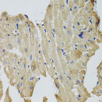 Immunohistochemistry - CKMT2 antibody (144-08088)