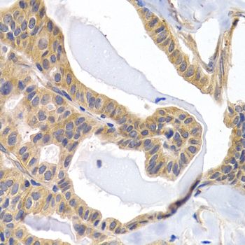 Immunohistochemistry - PTGIR Polyclonal Antibody (144-01849)