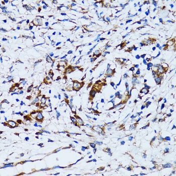 Immunohistochemistry - RARS antibody (144-06307)