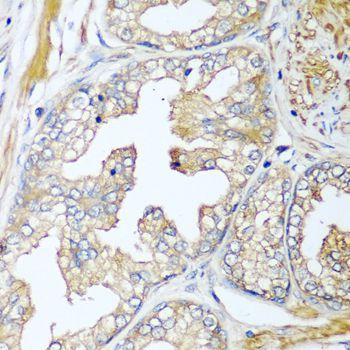 Immunohistochemistry - CFD antibody (144-08117)