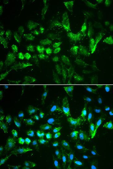 Immunofluorescence - TIMP2 antibody (144-61120)