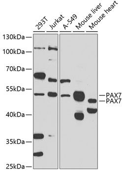 Western blot