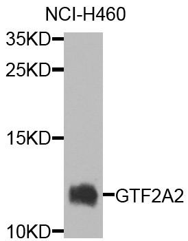 Western blot - GTF2A2 antibody (144-07680)