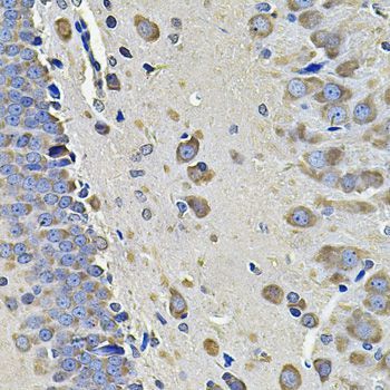 Immunohistochemistry - EIF3C Polyclonal Antibody (144-07022)