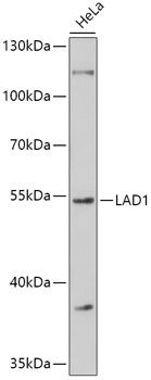 Western blot