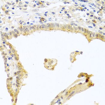 Immunohistochemistry - PRKCA Polyclonal Antibody (144-00267)