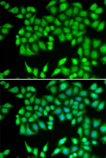 Immunohistochemistry - MCM3 Polyclonal Antibody (144-01060)