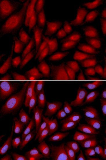 Immunofluorescence - BAG1 antibody (144-01104)