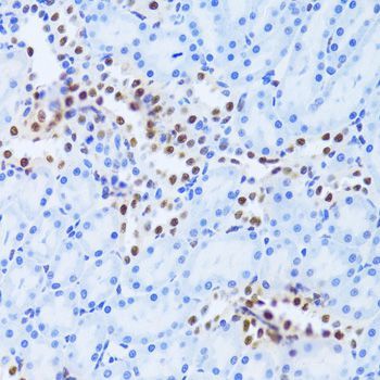 Immunohistochemistry - ANP32A Antibody (144-05768)