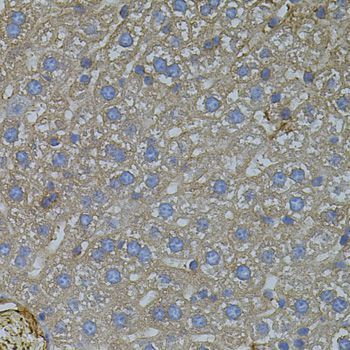 Immunohistochemistry - VEGFC antibody (144-02556)