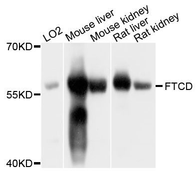 Western blot - FTCD antibody (144-09484)