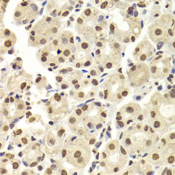 Immunohistochemistry - HNRNPD Polyclonal Antibody (144-01828)
