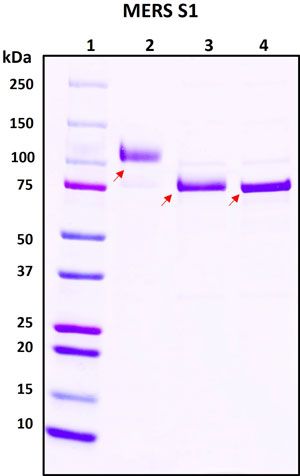 SDS-PAGE