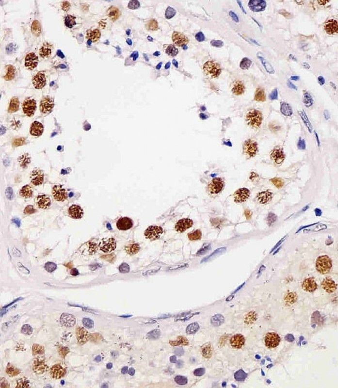 IHC-P
