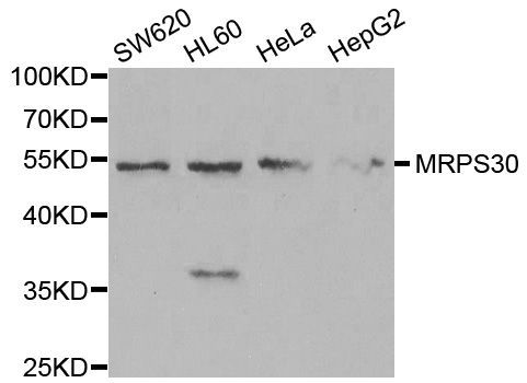 Western blot - MRPS30 Polyclonal Antibody (144-05841)