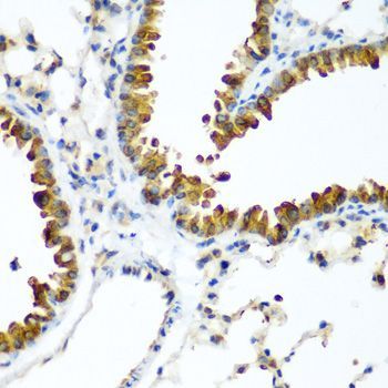 Immunohistochemistry - WWTR1 Polyclonal Antibody (144-08202)