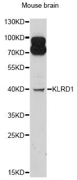 Western blot - KLRD1 antibody (144-600908)