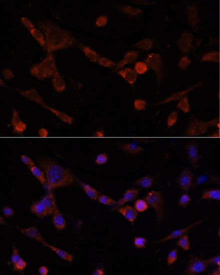 Immunofluorescence - CD4 Polyclonal Antibody (144-60019)