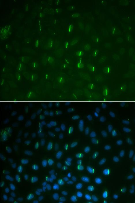 Immunohistochemistry - Phospho-Histone H2AFX-S139 pAb (144-50099)