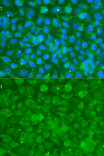 Immunofluorescence - SERPINA3 Polyclonal Antibody (144-01021)