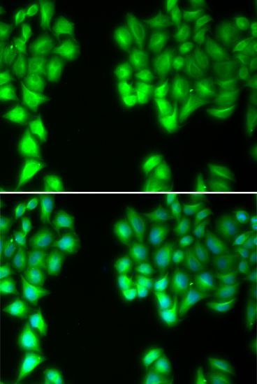 Immunofluorescence - MALT1 antibody (144-02144)