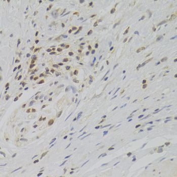 Immunohistochemistry - TAF1C Polyclonal Antibody (144-06759)