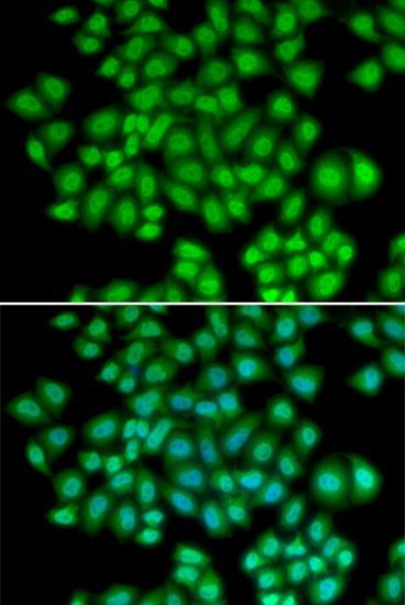 Immunofluorescence - ATF2 Polyclonal Antibody (144-02155)
