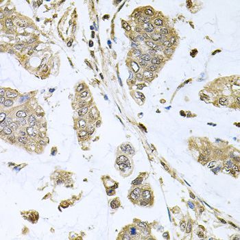 Immunohistochemistry - SBDS antibody (144-05876)