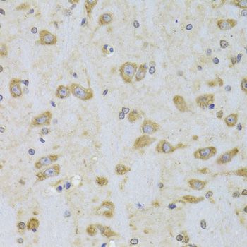 Immunohistochemistry - [KO Validated] EEF1B2 Polyclonal Antibody (144-06580)