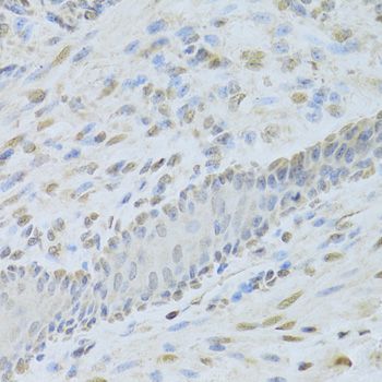 Immunohistochemistry - [KO Validated] AIFM1 Polyclonal Antibody (144-02568)